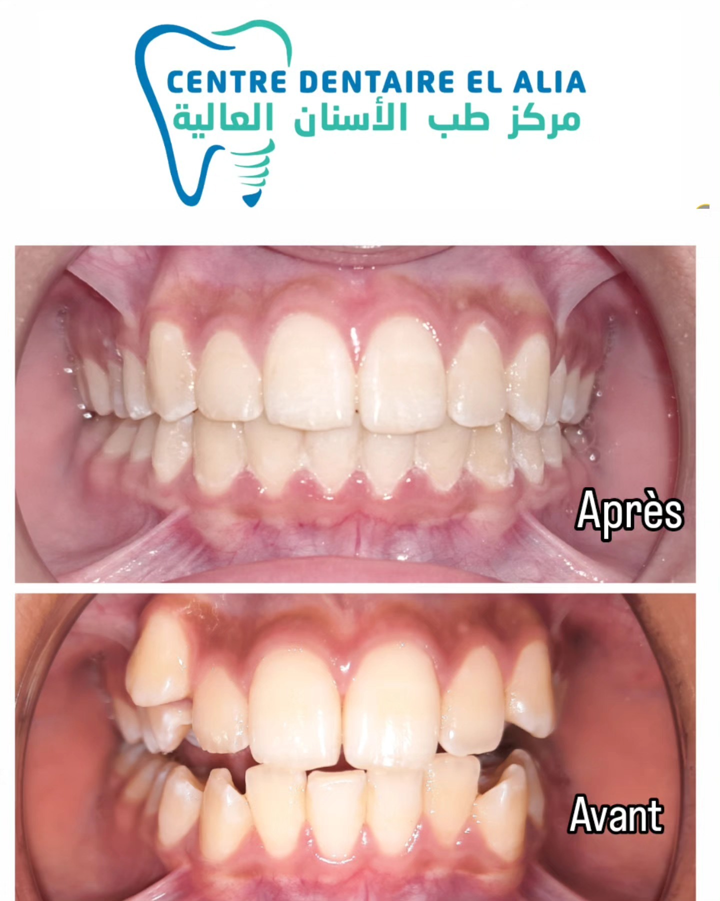 Transformation 1