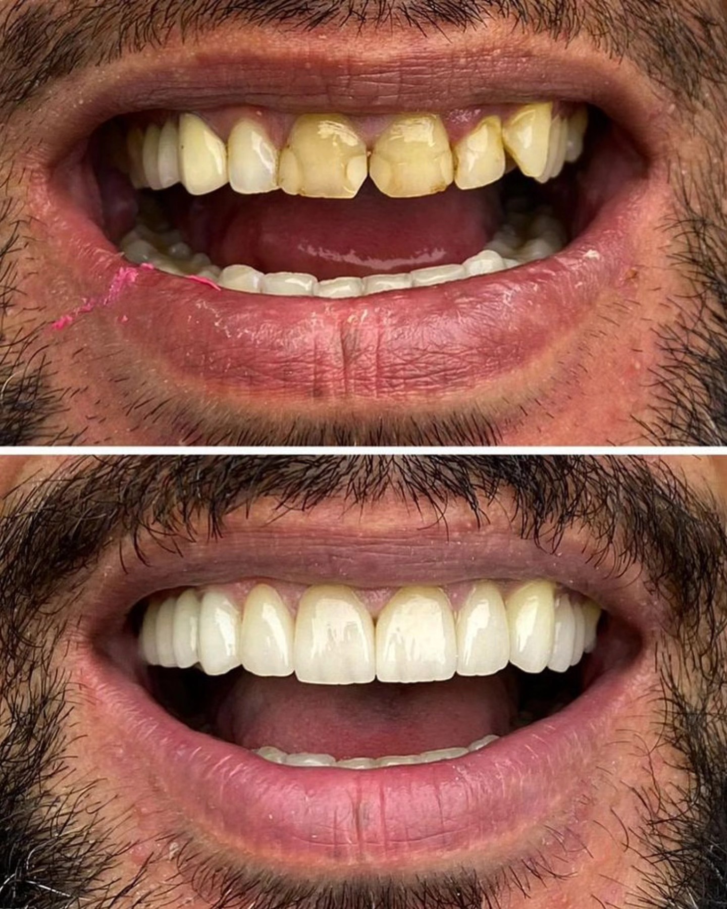 Transformation 3